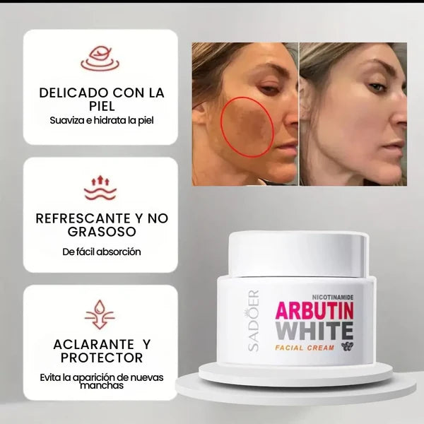 Crema Aclarante Arbutin White con Nicotinamida – Sadoer ⭐⭐⭐⭐⭐ENVIO GRATIS-PAGO CONTRAENTREGA