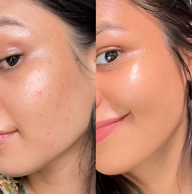 Serum de arroz skinpro⭐⭐⭐⭐⭐,,(ENVIO GRATIS 🔥)PAGO CONTRA ENTREGA🚛 -