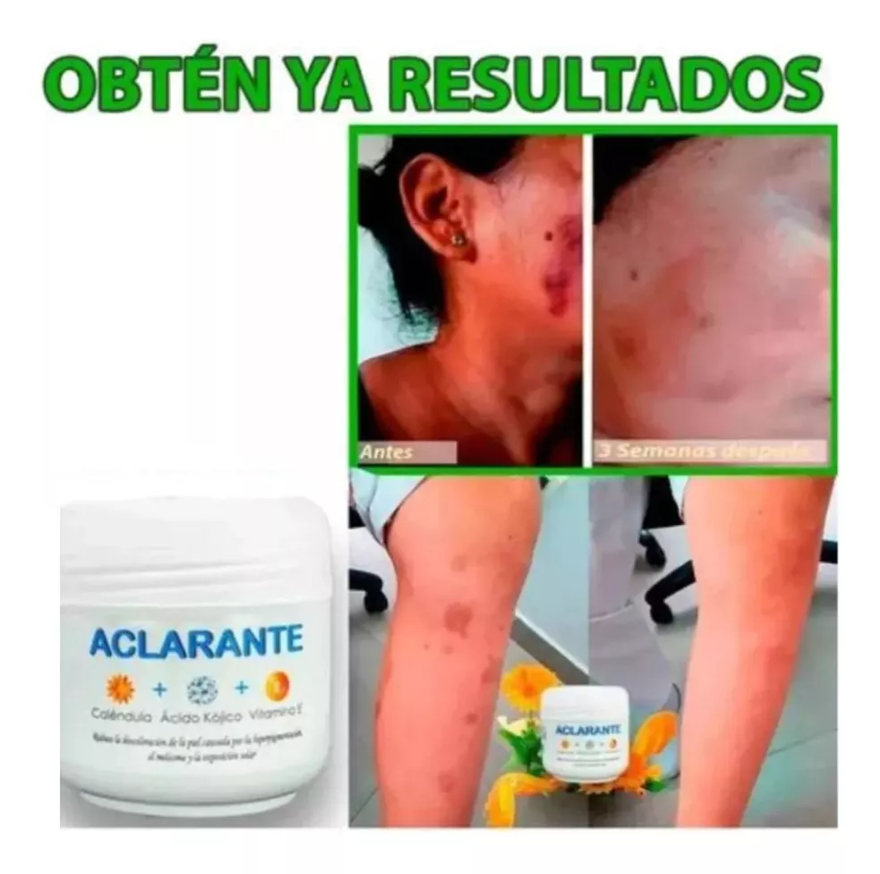 Crema Aclarante X 2unidades Y LLEVAS OBSEQUIO CREMA ALIVIO ARTICULAR (ENVIO GRATIS 🔥)PAGO CONTRA ENTREGA/🚛