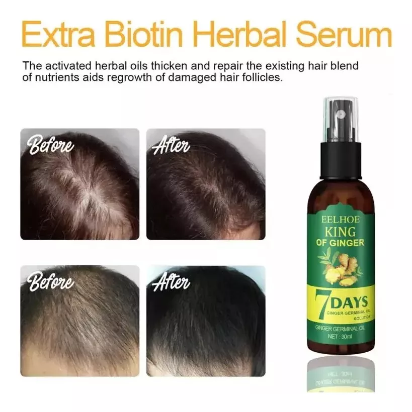 7 Days Crecimiento Capilar spray⭐⭐⭐⭐⭐ (ENVIO GRATIS 🔥)PAGO CONTRA ENTREGA🚛.