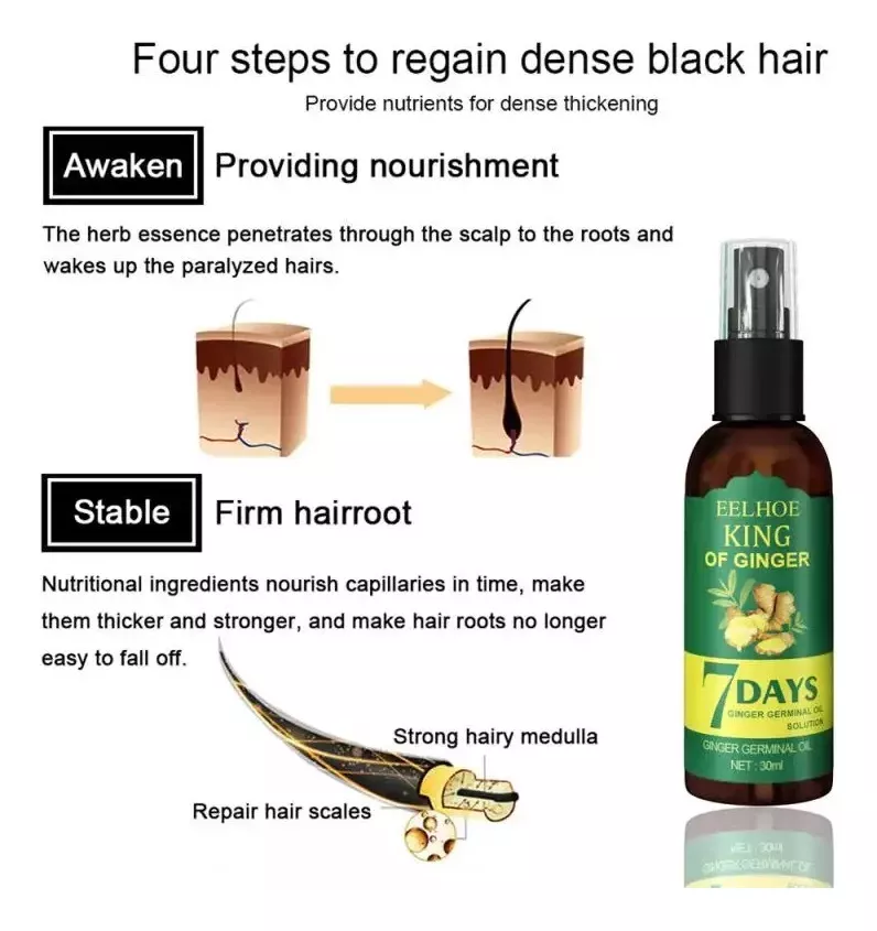 7 Days Crecimiento Capilar spray⭐⭐⭐⭐⭐ (ENVIO GRATIS 🔥)PAGO CONTRA ENTREGA🚛.