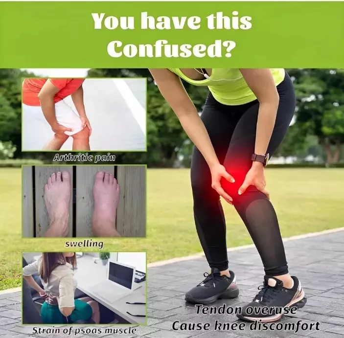 Crema Veneno Abeja Alivio X 2 Unidades Y LLEVAS OBSEQUIO CREMA ACLARANTE PIEL (ENVIO GRATIS 🔥)PAGO CONTRA ENTREGA/🚛 -