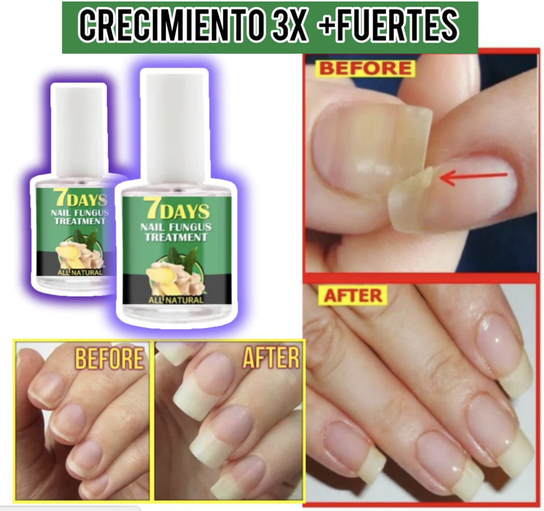 Endurecedor de uñas 4K potente crecimiento & hongos0(COMPRA 1 Y LLEVAS 3 EN TOTAL)⭐⭐⭐⭐⭐,‼️(ENVIO GRATIS 🔥)PAGO CONTRA ENTREGA🚛. - mega-store-colombi