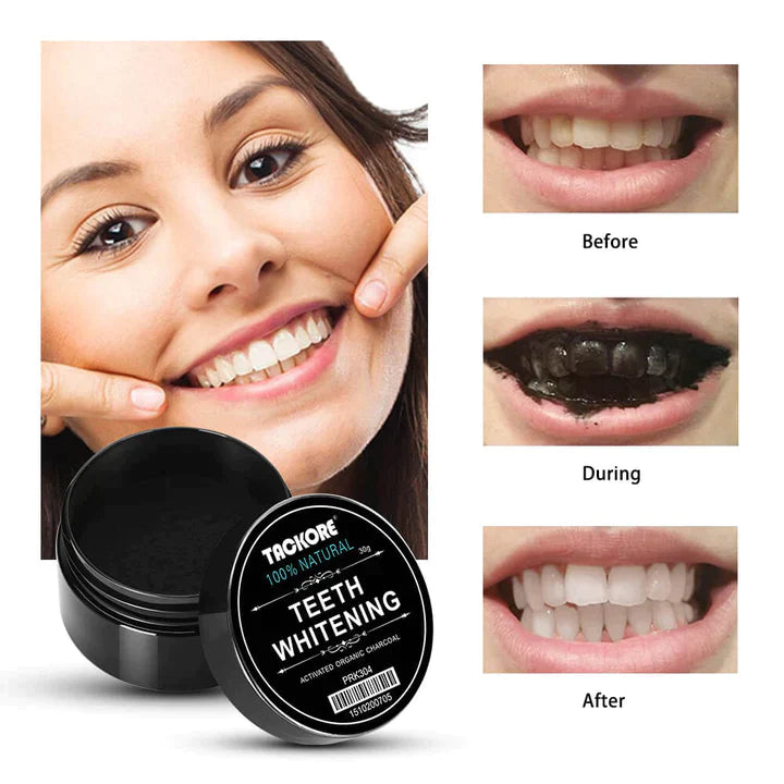 Blanqueador Dental  Carbon  Organico Activado1⭐⭐⭐⭐⭐,Ultimas Unidades,‼️(Envio Gratis 🔥)Pago Contra Entrega🚛. - mega-store-colombi