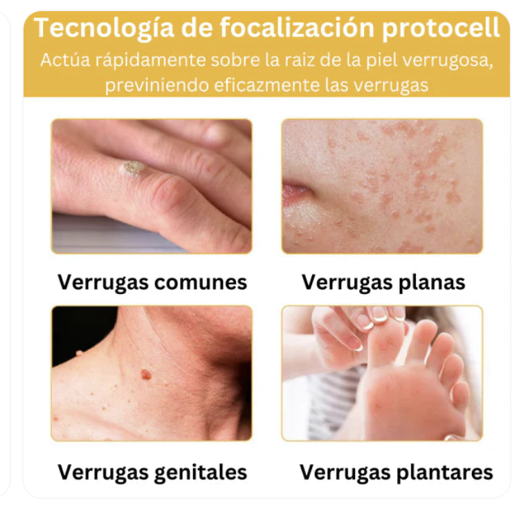 Tag Recede Eliminador de verrugas-OBSEQUIO CREMA ACLARANTE⭐⭐⭐⭐⭐,,(ENVIO GRATIS 🔥)PAGO CONTRA ENTREGA🚛