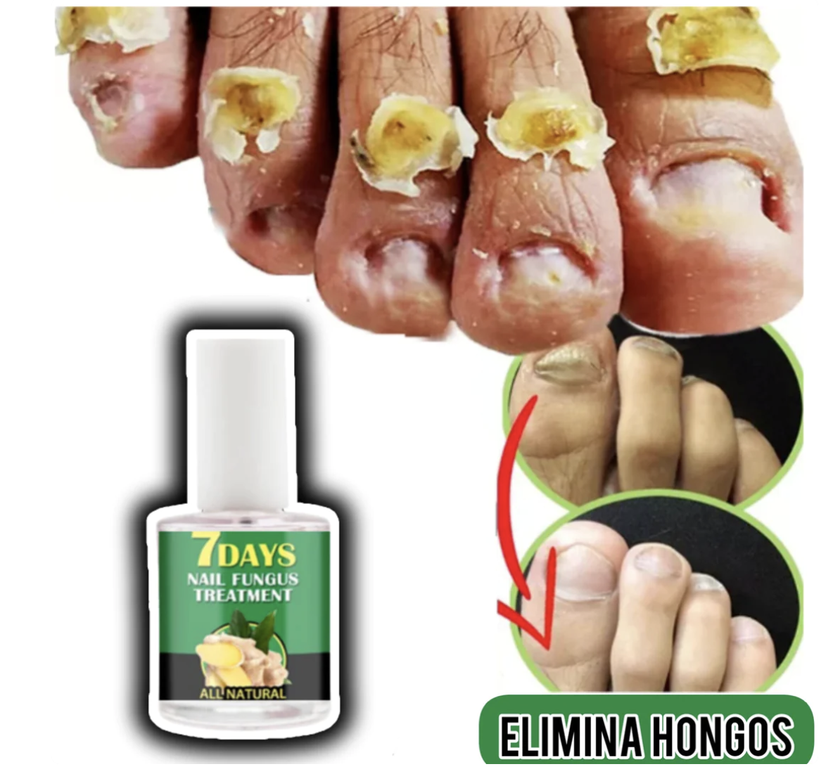 Endurecedor de uñas 4K potente crecimiento & hongos (COMPRA 1 Y LLEVAS 3 EN TOTAL🎁🎁🎁) ⭐⭐⭐⭐⭐,‼️(ENVIO GRATIS 🔥)PAGO CONTRA ENTREGA🚛. - mega-store-colombi