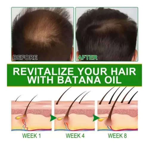 Aceite de Batana - Nutrición Profunda Desde la Raíz, OBSEQUIO CREMA ACLARANTE PIEL, (ENVIO GRATIS )PAGO CONTRA ENTREGA⭐⭐⭐⭐⭐ (Cop