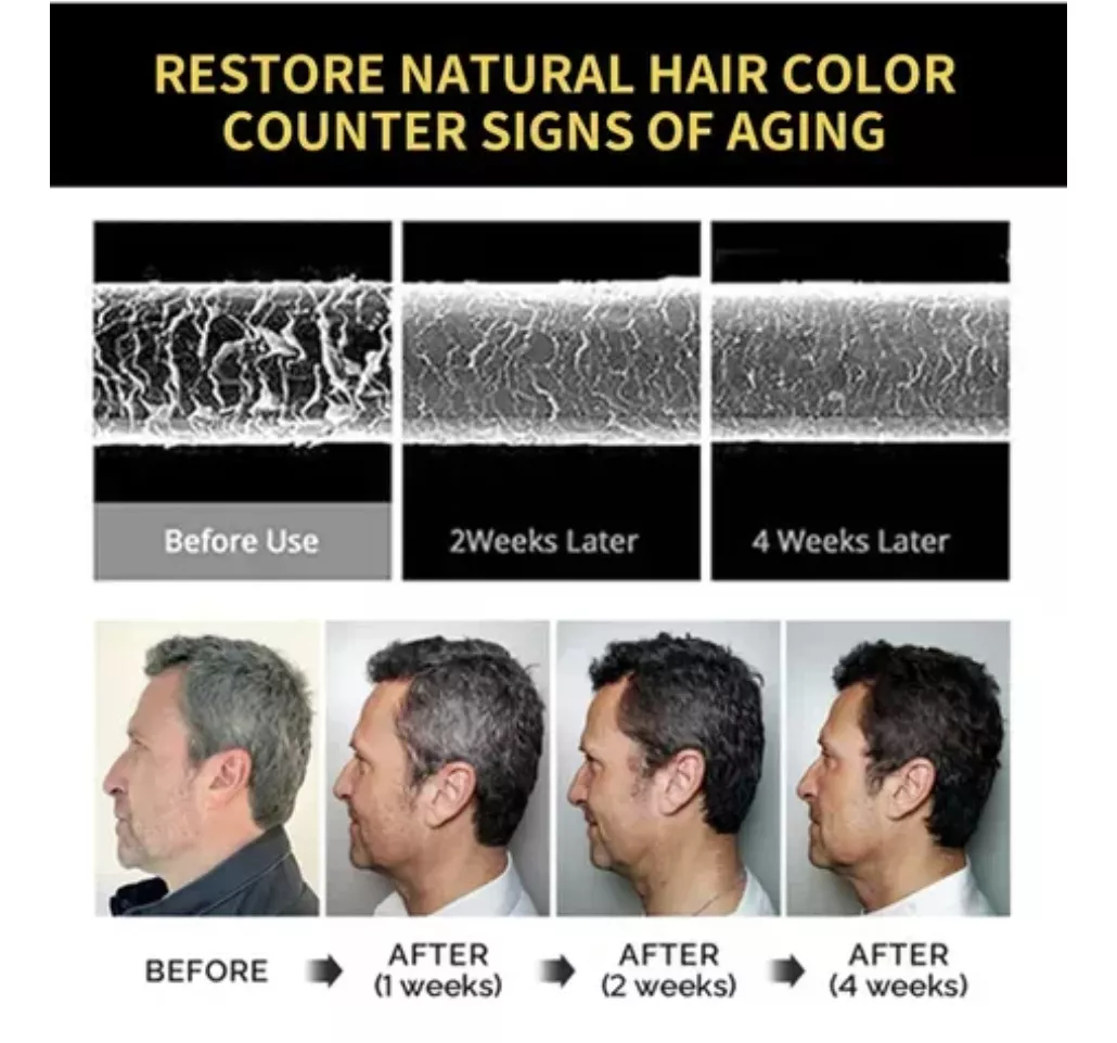 Shampoo Black Hair Dye Anticana⭐⭐⭐⭐⭐ (ENVIO GRATIS 🔥)PAGO CONTRA ENTREGA🚛.
