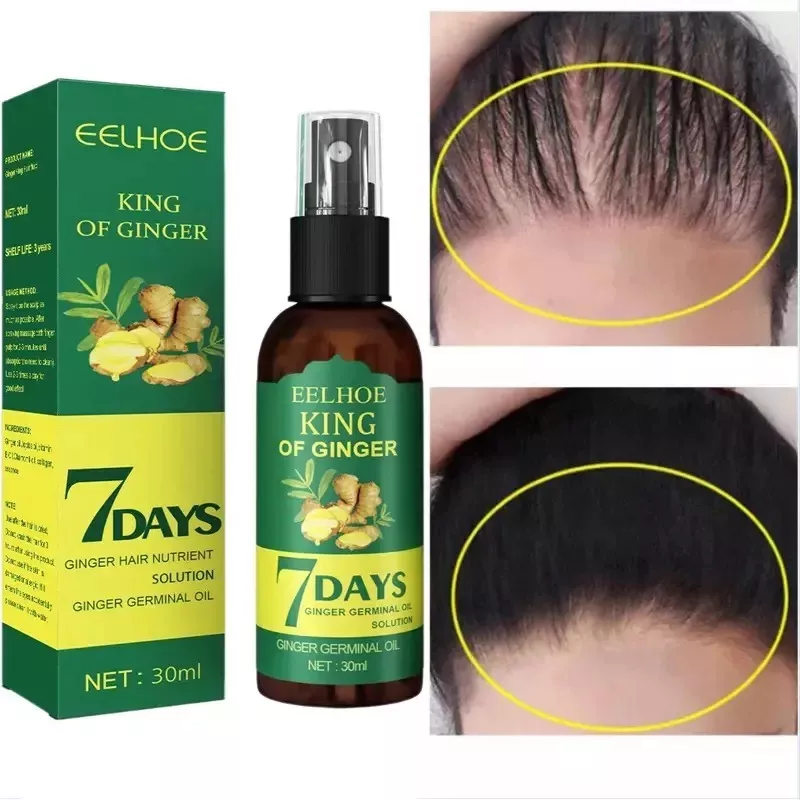 7 Days Crecimiento Capilar spray⭐⭐⭐⭐⭐ (ENVIO GRATIS 🔥)PAGO CONTRA ENTREGA🚛.